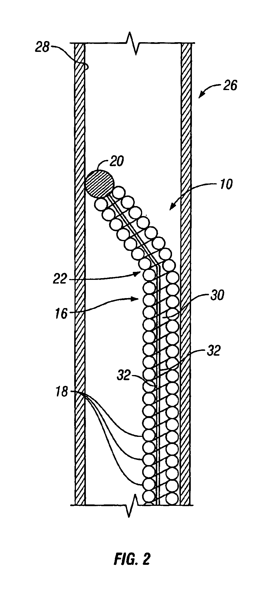 Device for sensing parameters of a hollow body organ