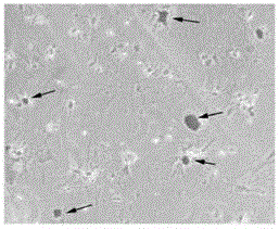 A method for inducing bone marrow mesenchymal stem cells to differentiate into osteoblasts in vitro and induction medium