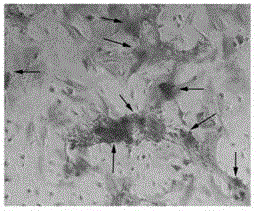 A method for inducing bone marrow mesenchymal stem cells to differentiate into osteoblasts in vitro and induction medium