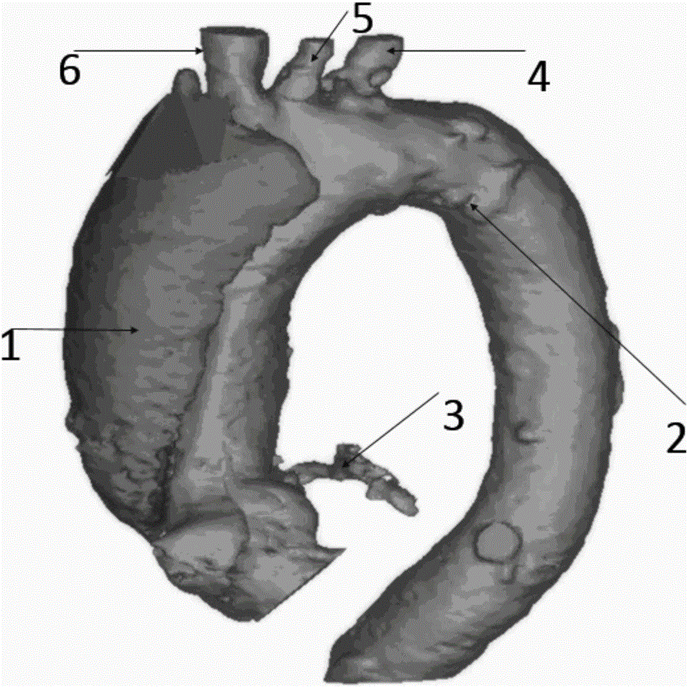 Aneurysm model based on 3D printing and manufacturing method thereof