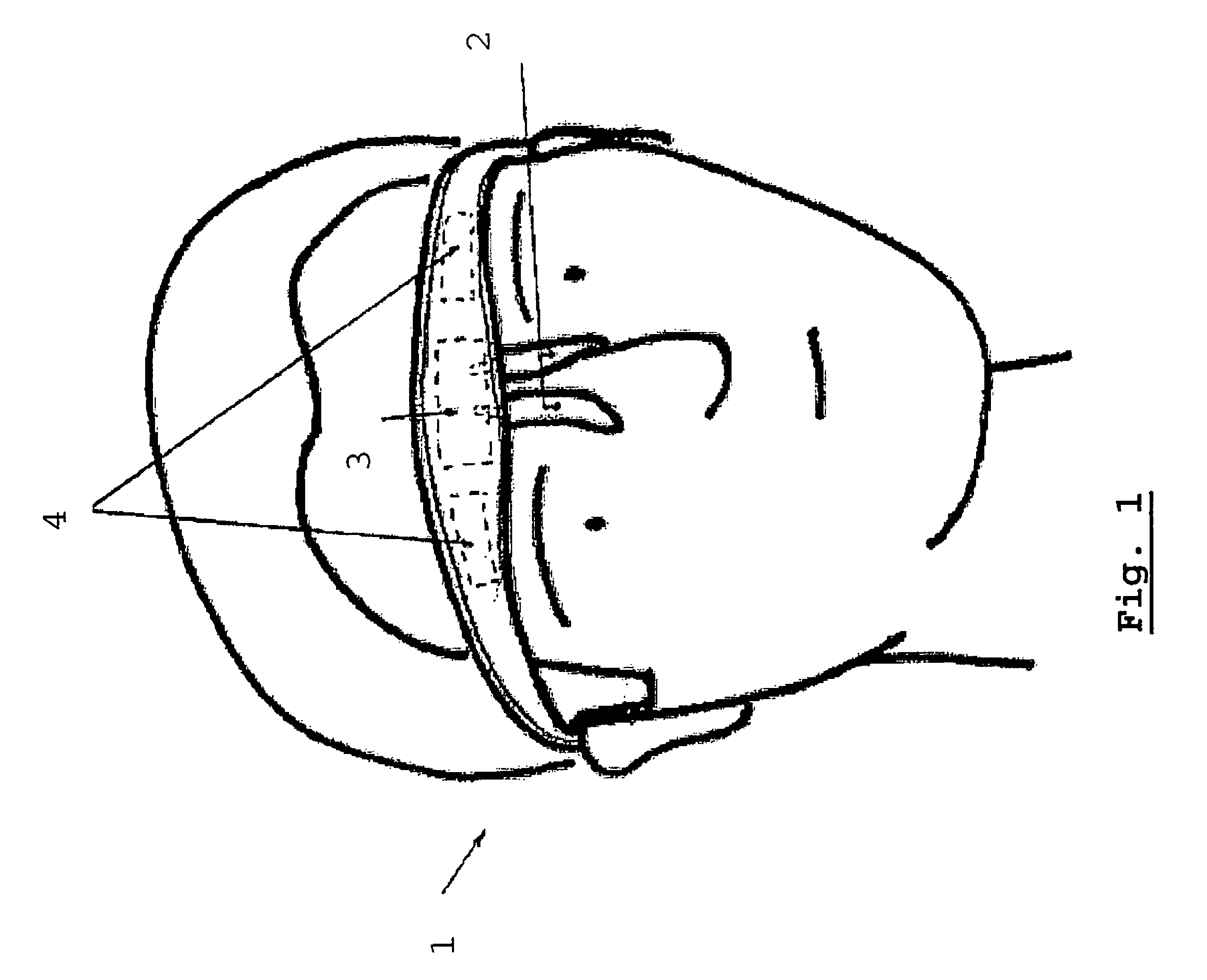 Apparatus for electro-inhibition of facial muscles