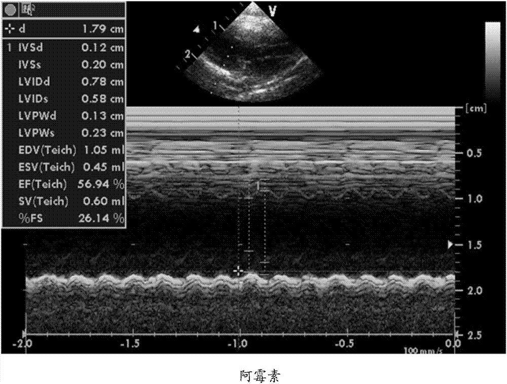 Application of protosappanin A derivative in protecting cardiac trauma caused by chemotherapeutics