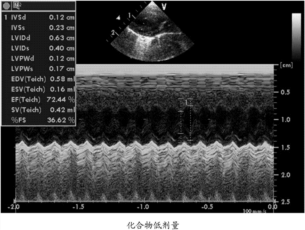 Application of protosappanin A derivative in protecting cardiac trauma caused by chemotherapeutics