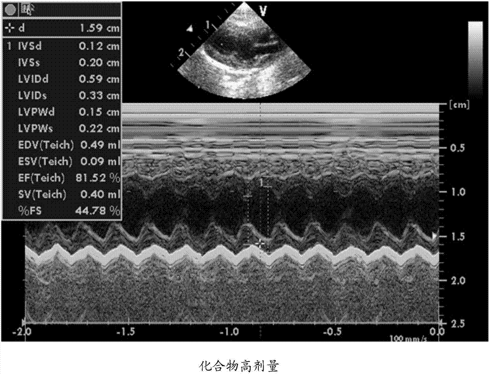 Application of protosappanin A derivative in protecting cardiac trauma caused by chemotherapeutics