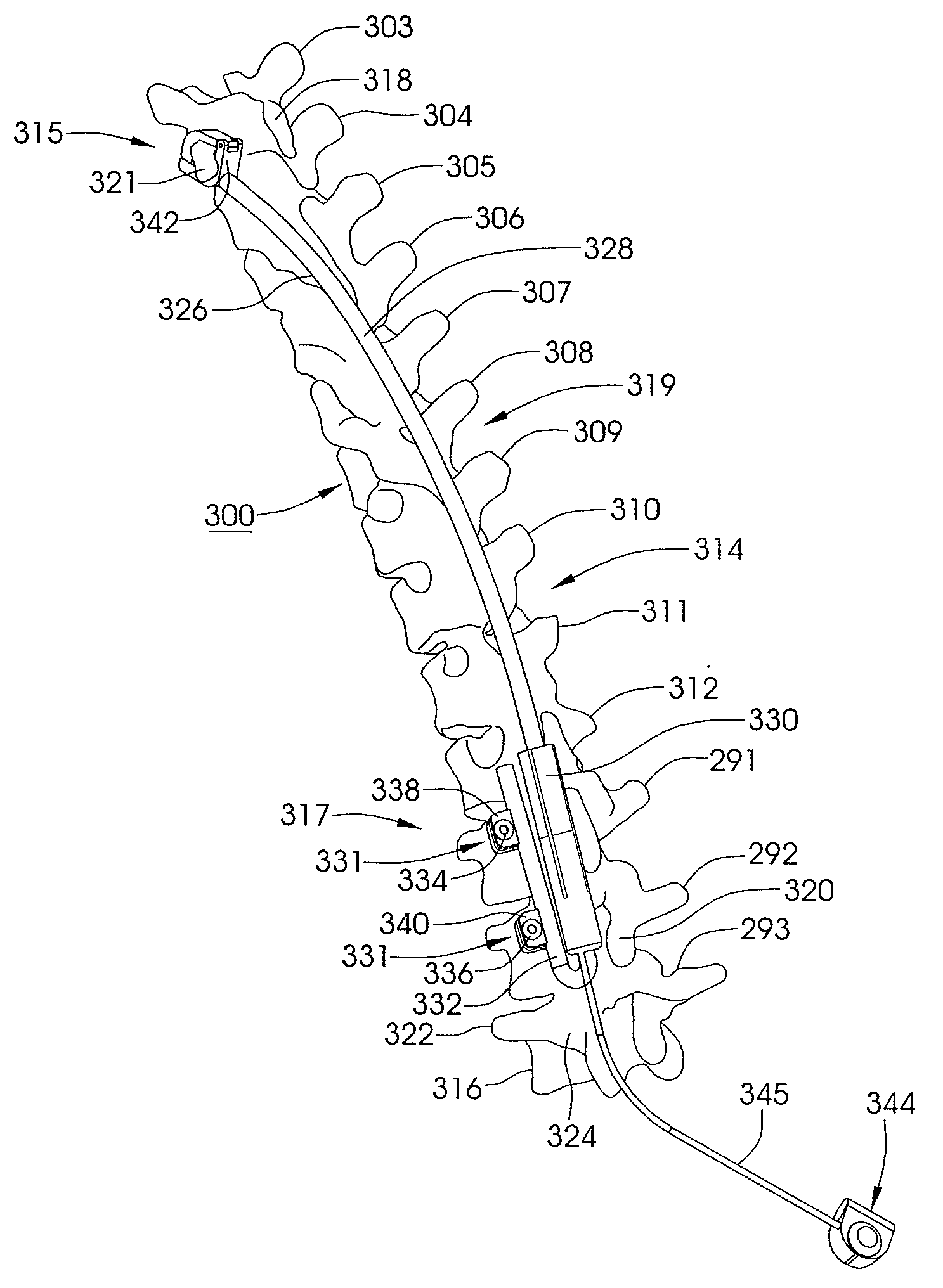 Skeletal manipulation method