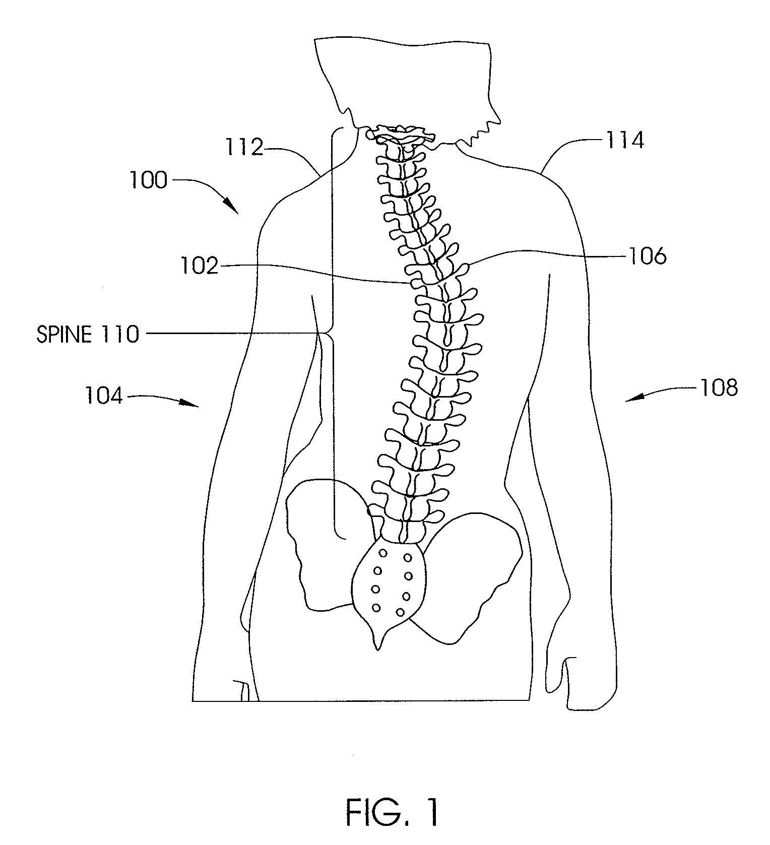 Skeletal manipulation method