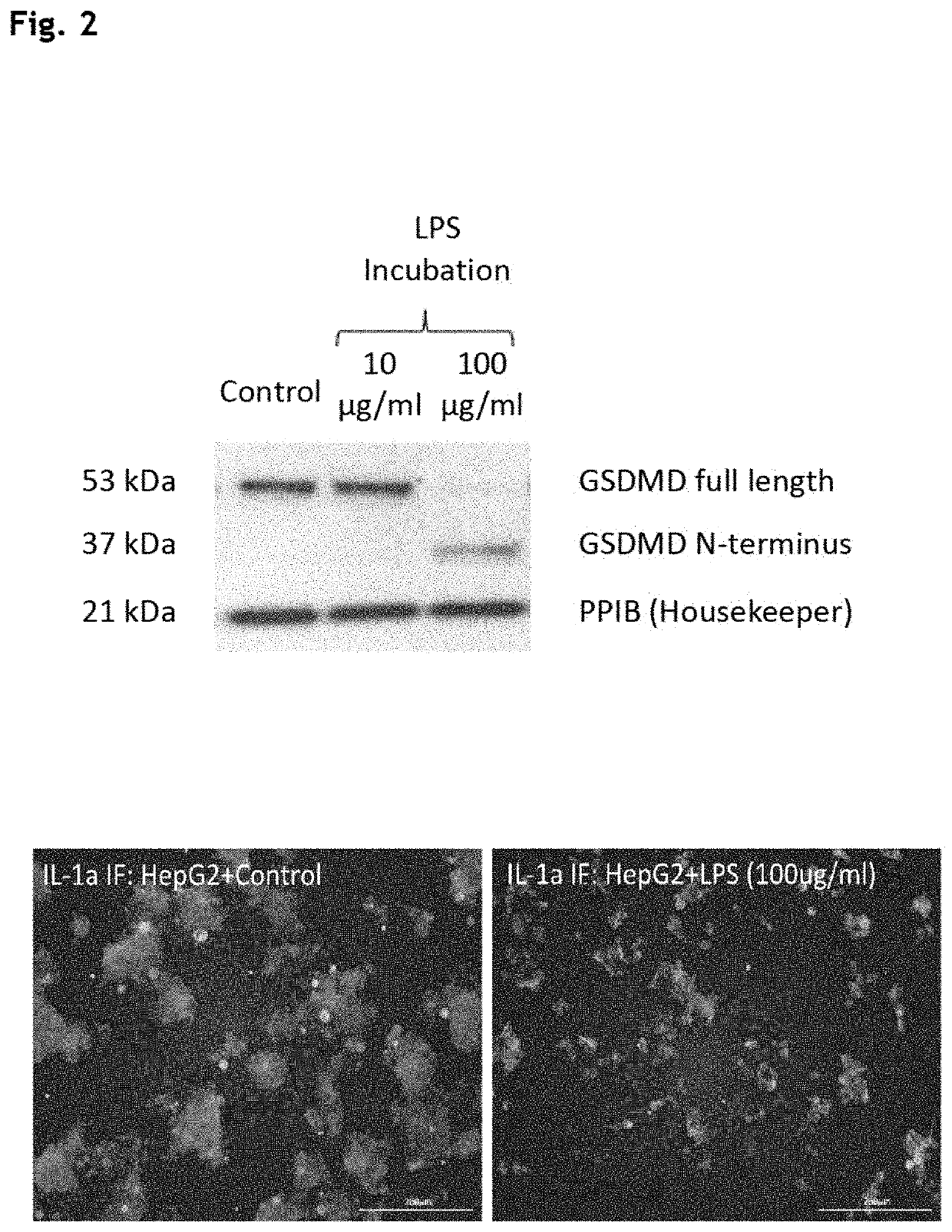 Treatment of pyroptosis