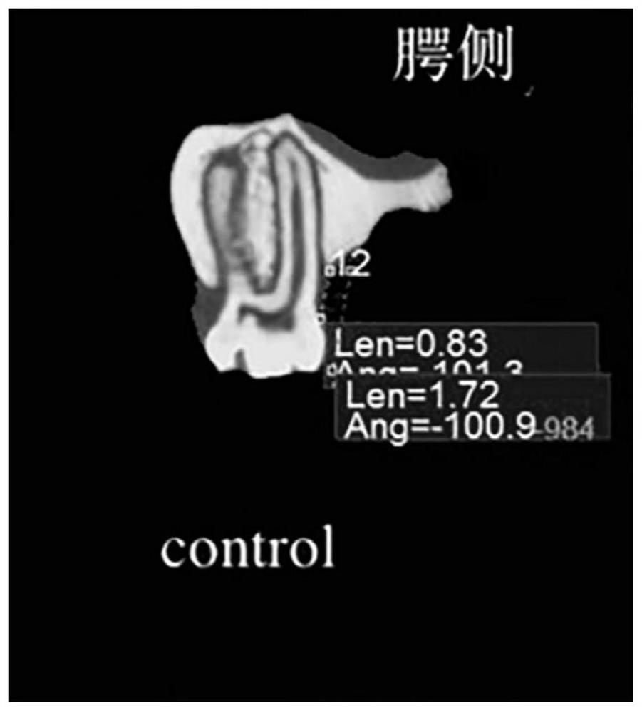 Method for establishing rat periodontitis model