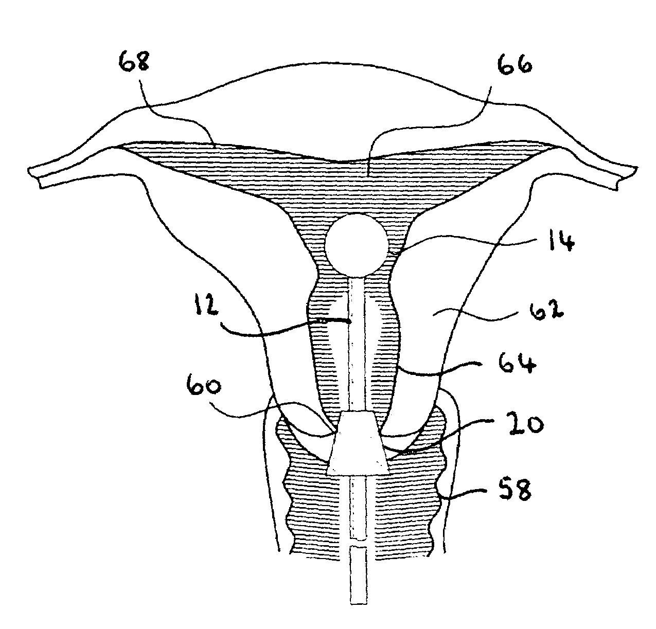 Apparatus for cervical manipulation and methods of use