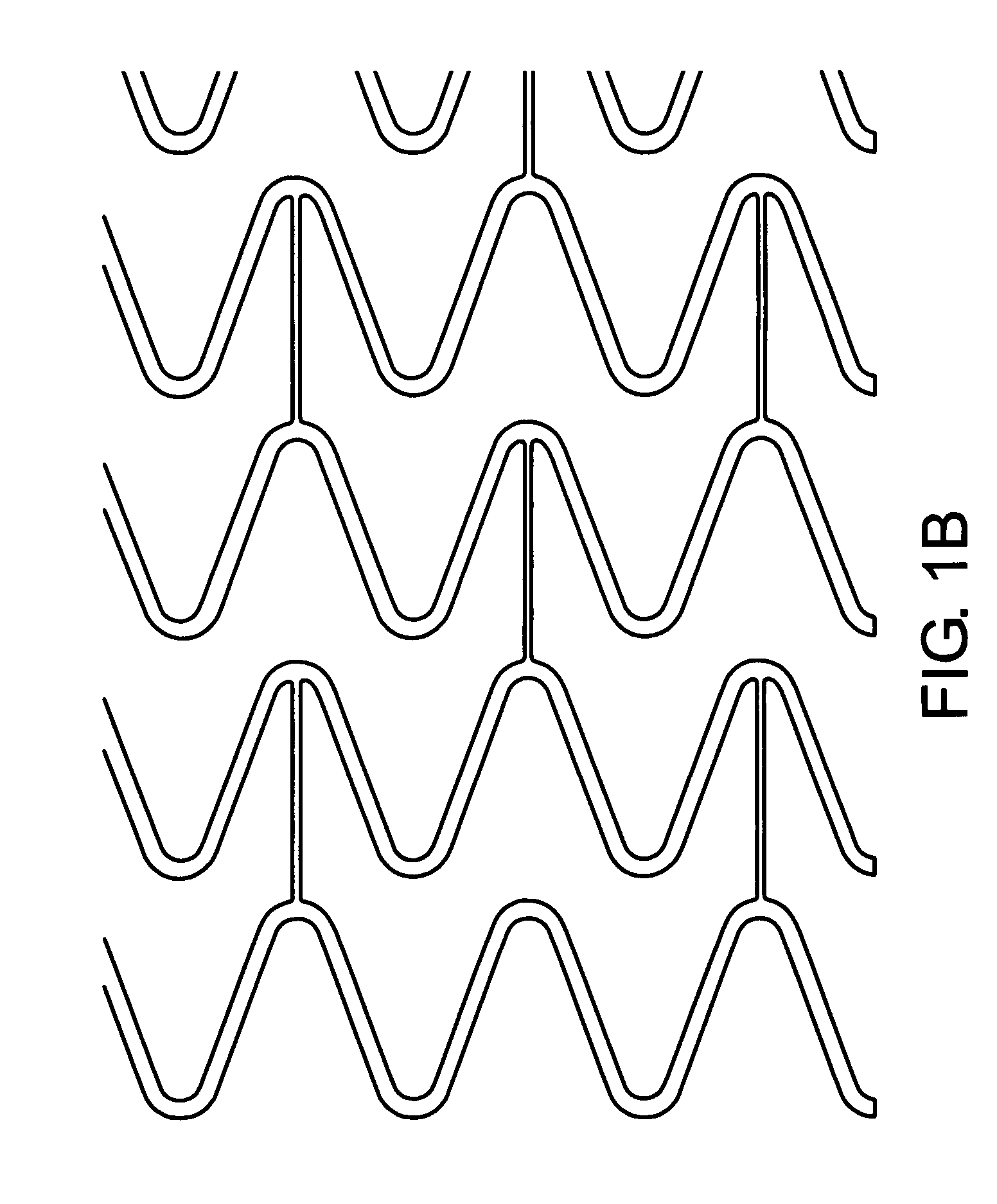 Expandable vascular endoluminal prostheses