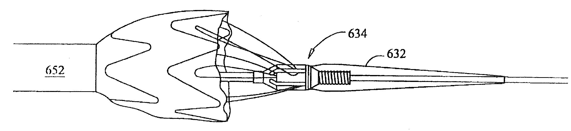 Sheath Capture Device for Stent Graft Delivery System and Method for Operating Same