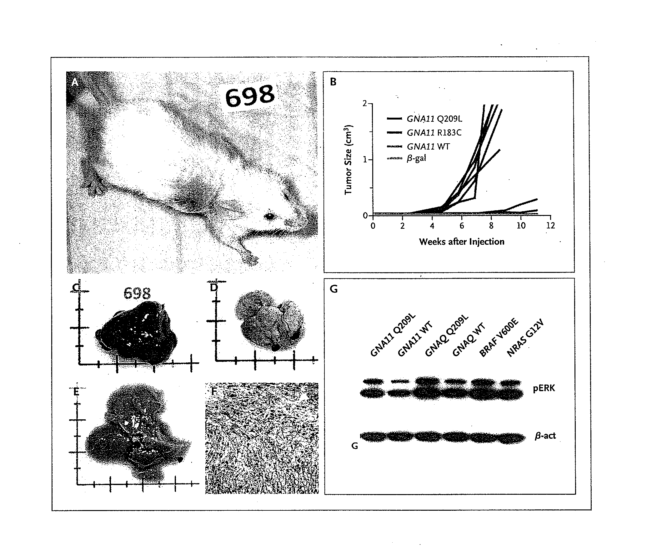 Gna11 and gnaq exon 4 mutations in melanoma