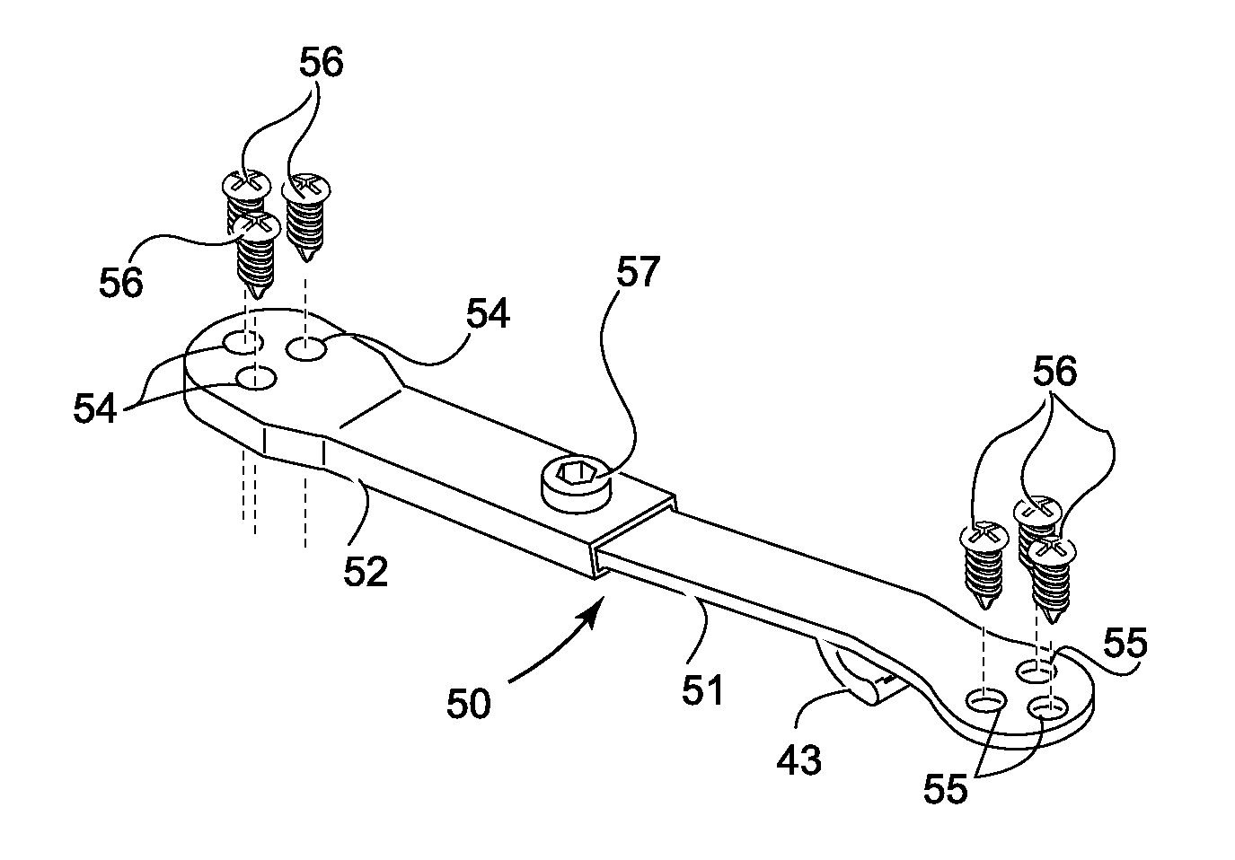 Expandable Laminoplasty Fixation System