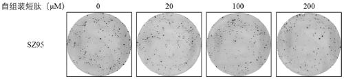 Self-assembly short-chain peptide and application of short-chain peptide in treatment of acne