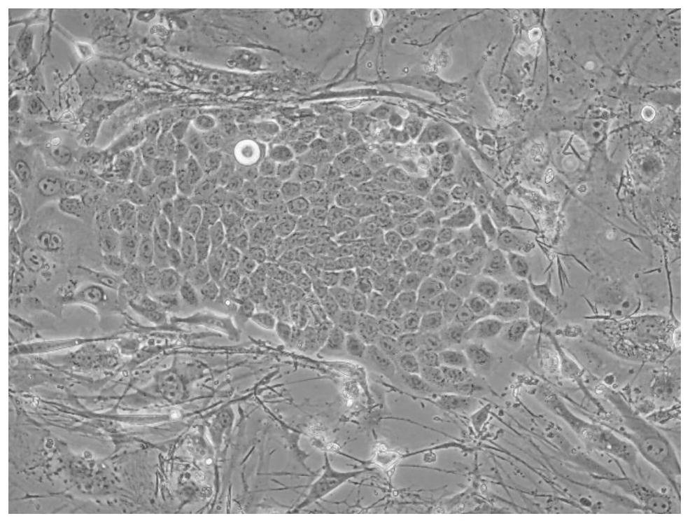 Application of bronchial basal layer cells in preparation of medicine for treating COPD (chronic obstructive pulmonary disease)