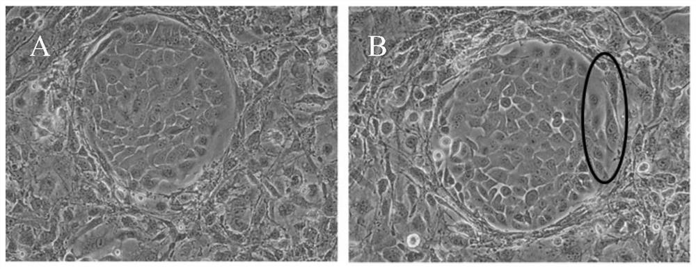 Application of bronchial basal layer cells in preparation of medicine for treating COPD (chronic obstructive pulmonary disease)