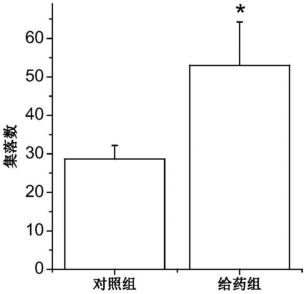 Application of TPO (thrombopoietin) receptor agonist in promoting homing of HSCs (hematopoietic stem cells)