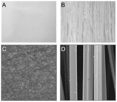 Bionic degradable artificial nerve conduit for regulating and controlling immune microenvironment and guiding regeneration by utilizing topological structure, and preparation method of bionic degradable artificial nerve conduit