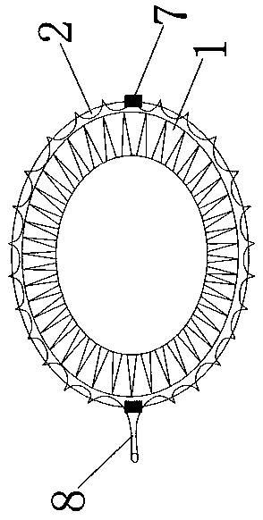 A fully fitting esophageal stent conforming to esophageal peristalsis