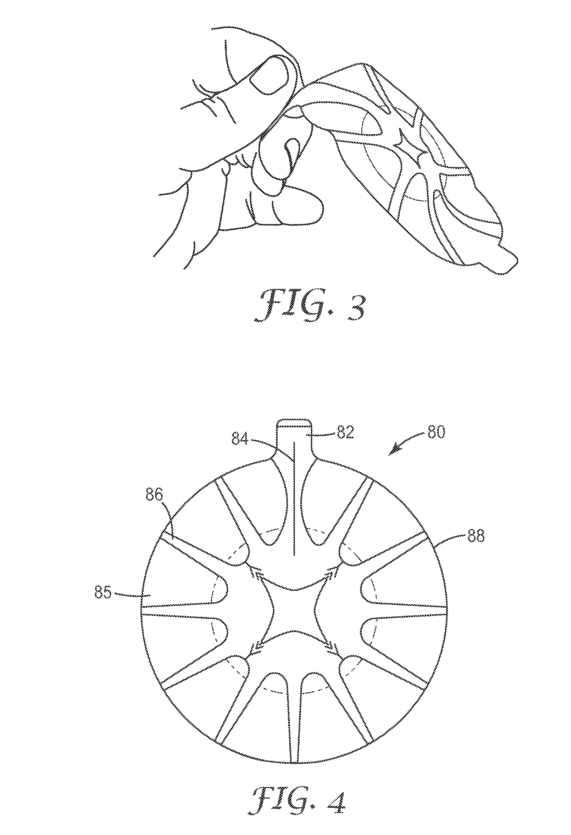 Conformable wound dressing