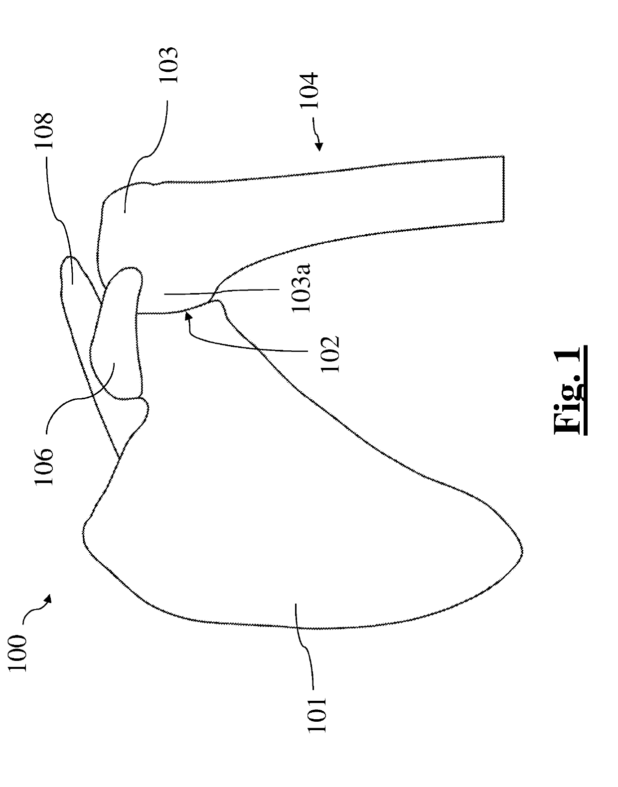 Method for surgical application of a glenoid prosthesis component of a shoulder joint prosthesis and relating surgical instruments