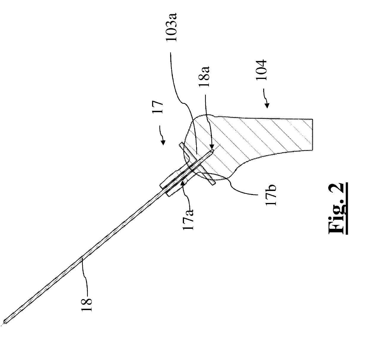 Method for surgical application of a glenoid prosthesis component of a shoulder joint prosthesis and relating surgical instruments