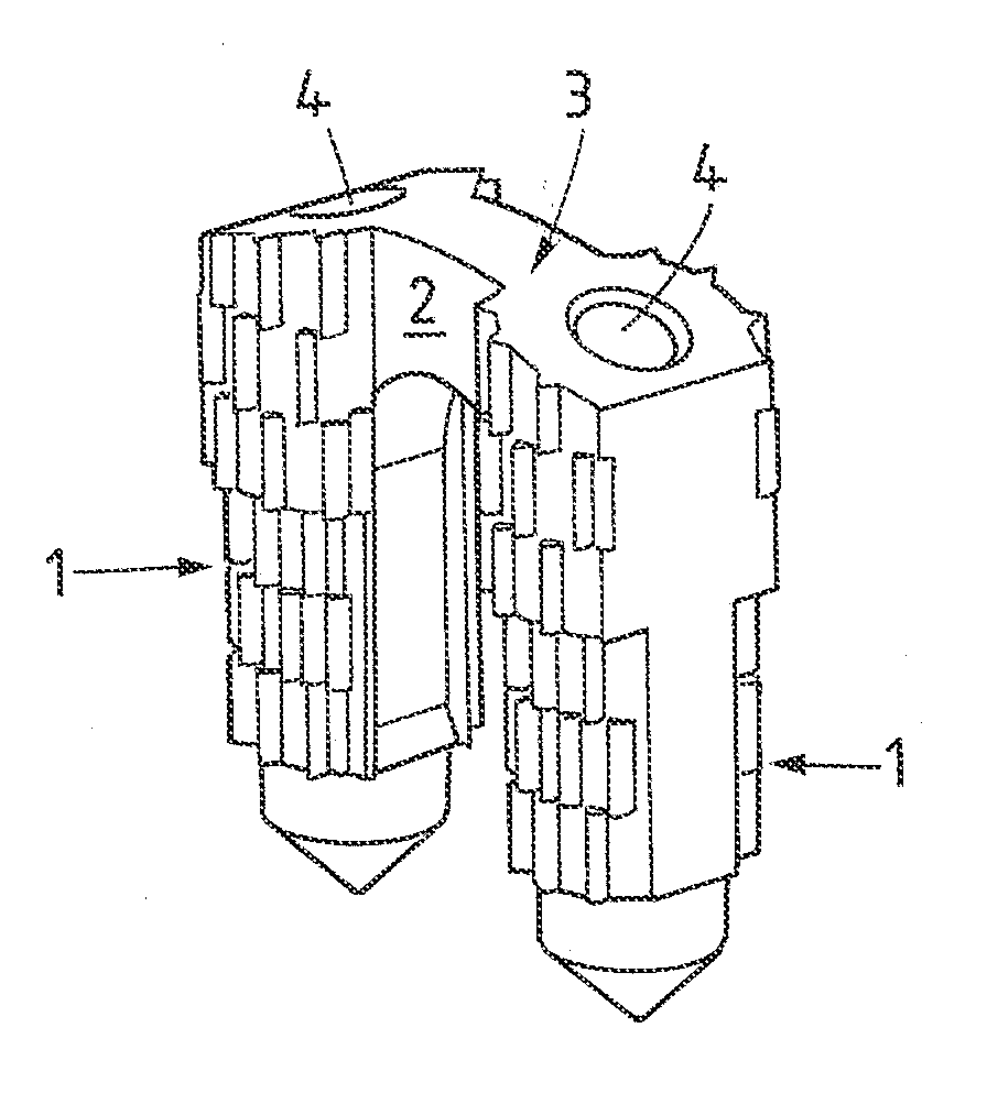 Method and implant for stabilizing two bone portions separated by a cut or fracture