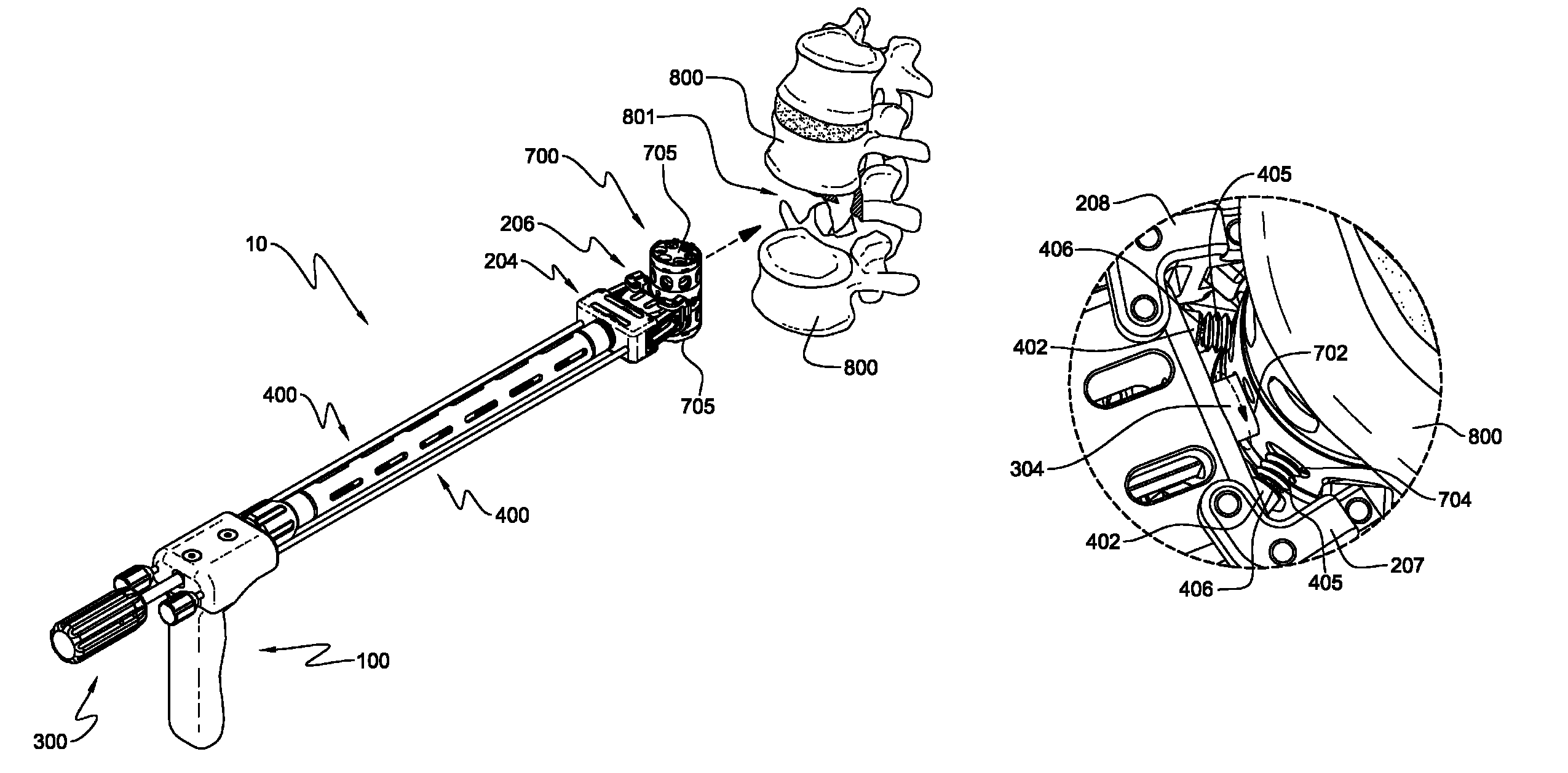 Surgical instrument and method of use for inserting an implant between two bones