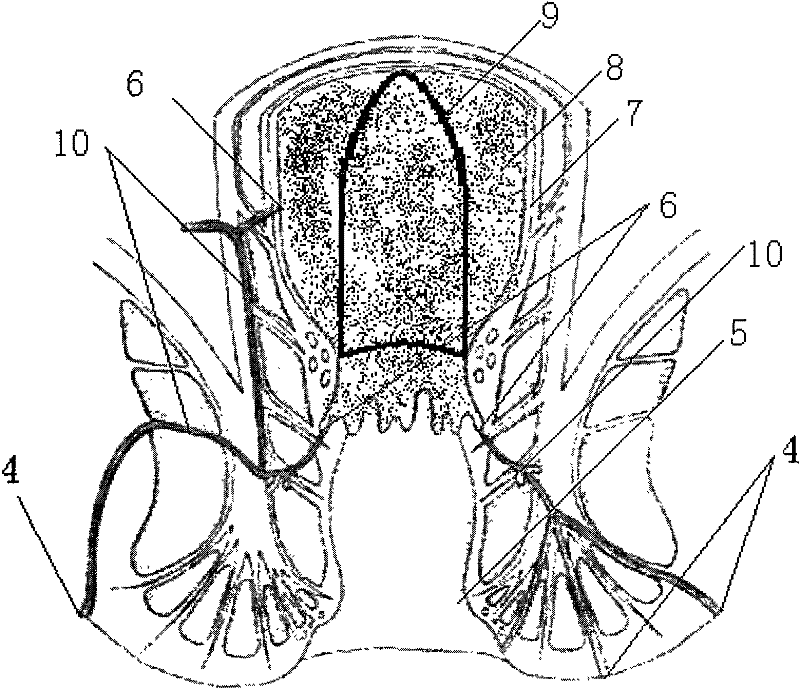 Anal fistula suppository