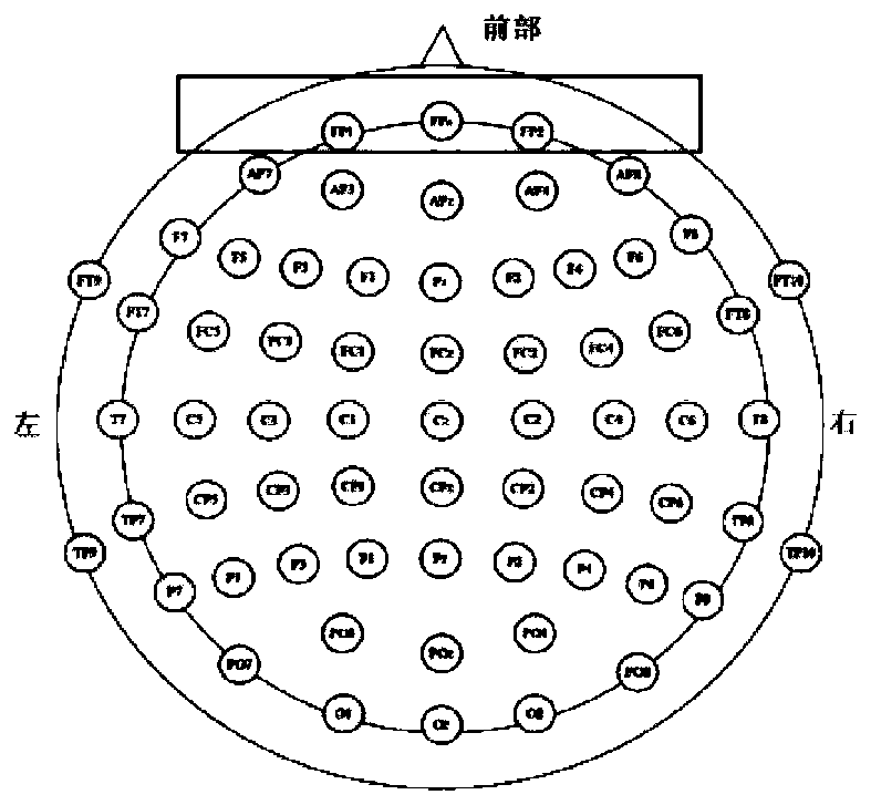 Portable electroencephalogram depression detection system in combination with demographic attention mechanism