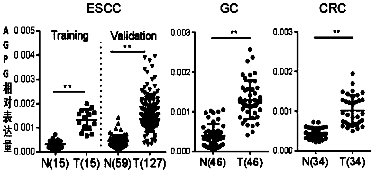 Application of molecular target in prognosis prediction and treatment of esophageal squamous cell carcinoma