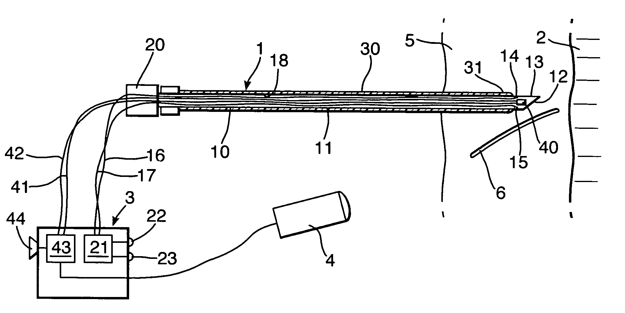 Tracheostomy apparatus