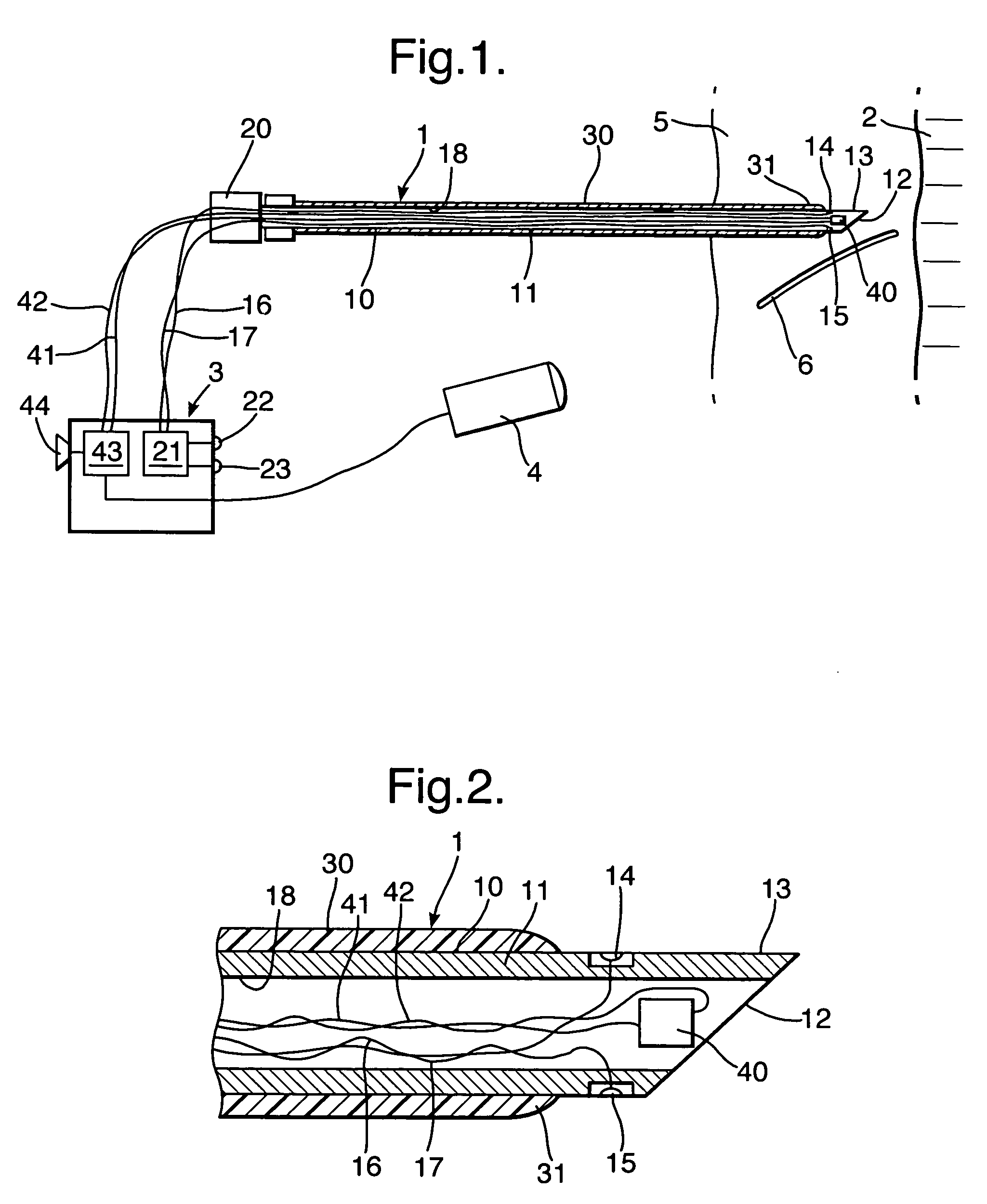 Tracheostomy apparatus