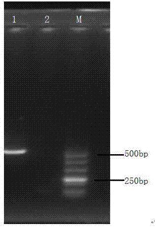 Nucleotide specific to legionella pneumophila O12 type wzm and wecA genes and application of nucleotide