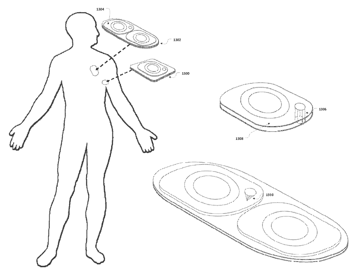 Method and apparatus for wireless health monitoring and emergent condition prediction