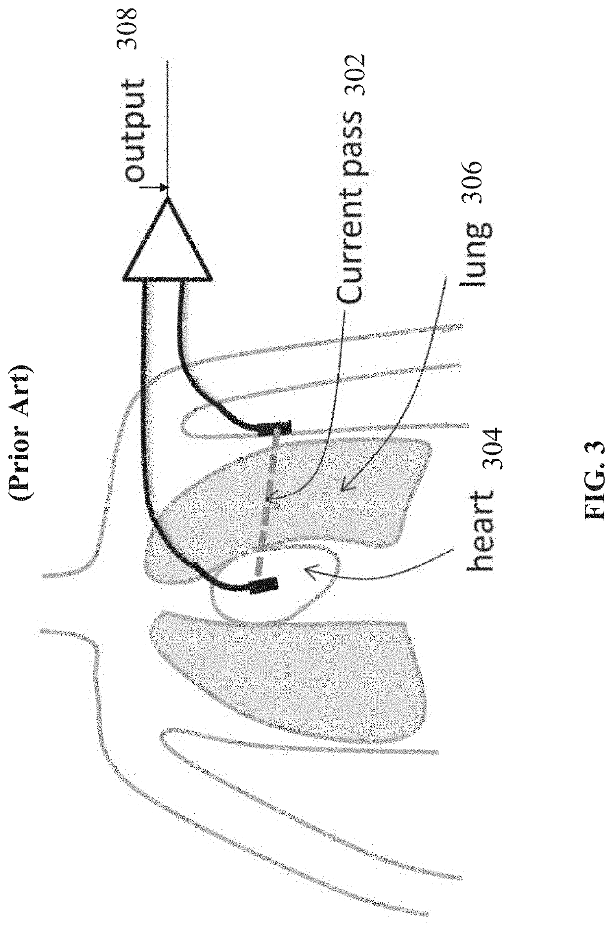 Systems and methods for sensing lung fluid and functionality