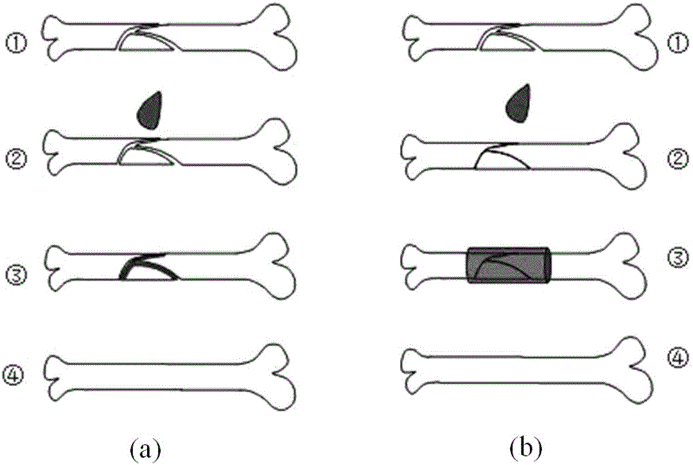 Application of PPF/PPF-DA (Poly(propylene fumarate)/Poly(propylene fumarate)-Diacrylate) light-curing material to preparation of bone adhesive tape