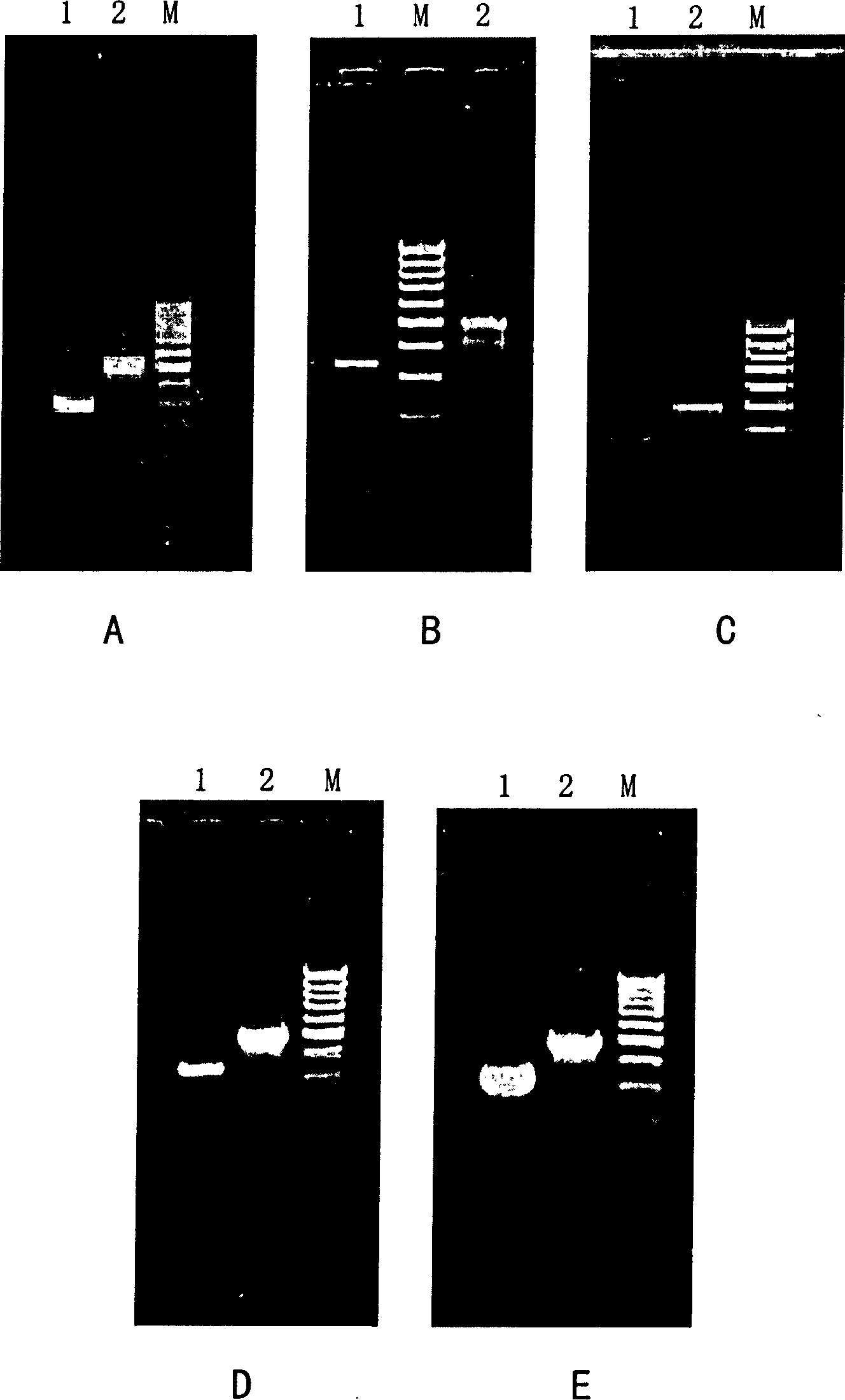 Fluorogenic quantitative PCR method for detecting interleukin 4 gene expression in peripheral-blood under physiological state