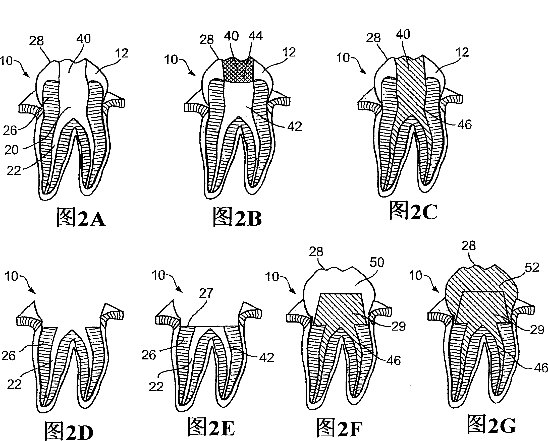 Oral devices and methods for controlled drug delivery