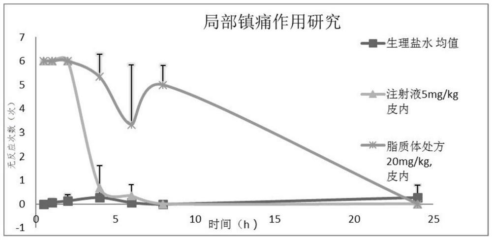 Preparation method of local anesthetic liposome