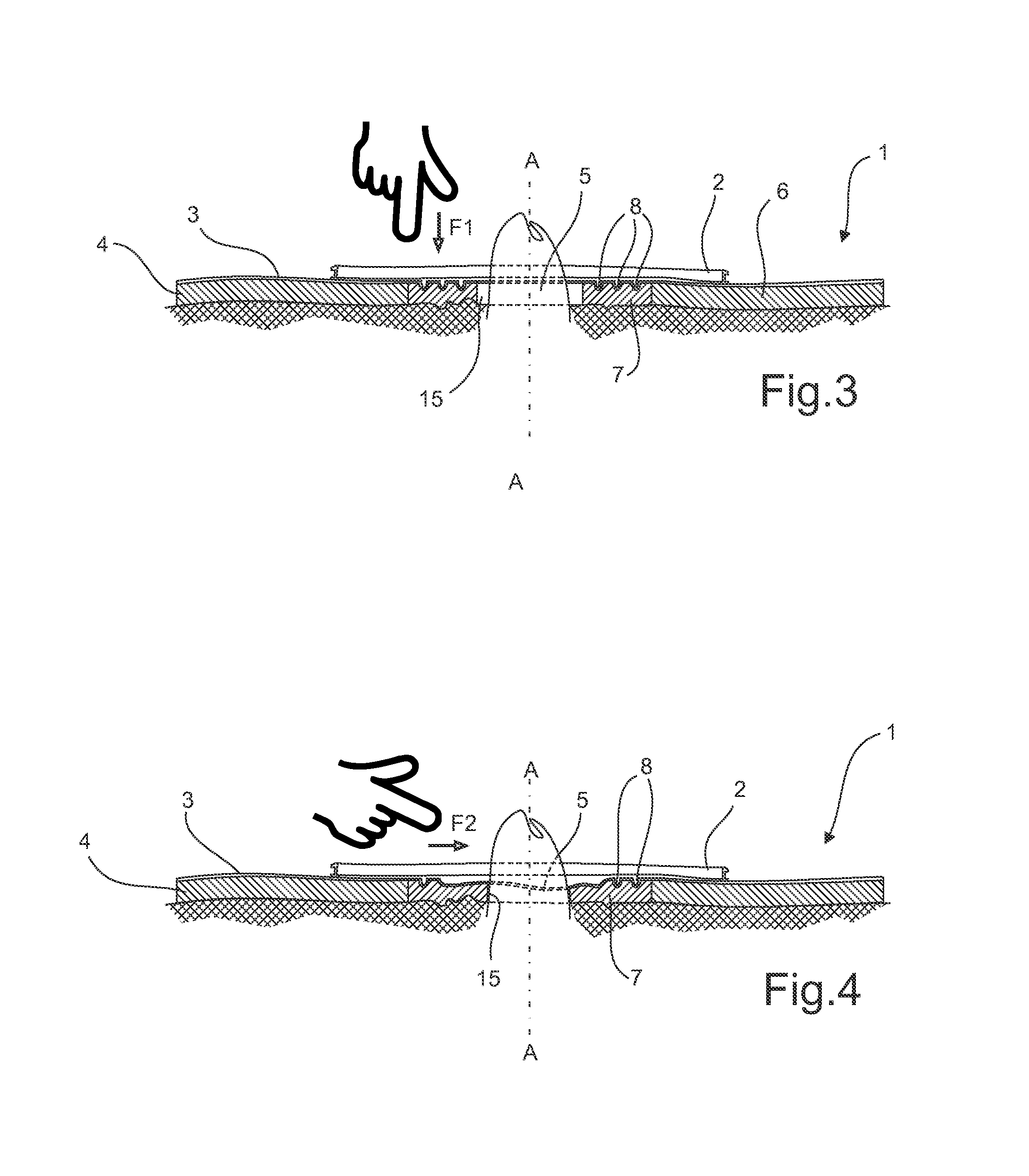 Ostomy base plate with mouldable centre part