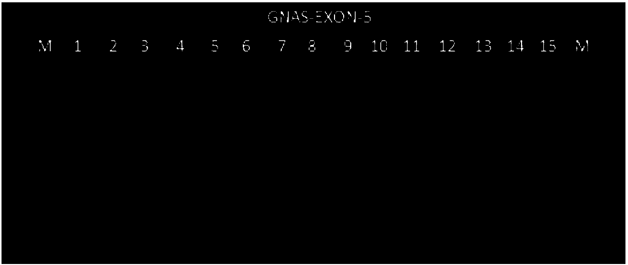 Primers and method for detecting mutation of GNAS genetic locus