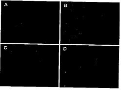 Chlorotoxin-modified glioma targeting gene delivery compound and preparation method thereof