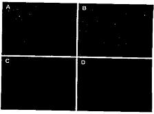 Chlorotoxin-modified glioma targeting gene delivery compound and preparation method thereof