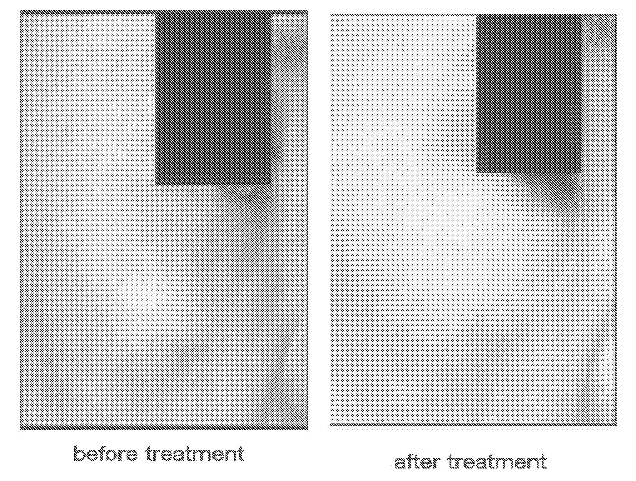 Composition and Method for Inhibition of Melanin Synthesis