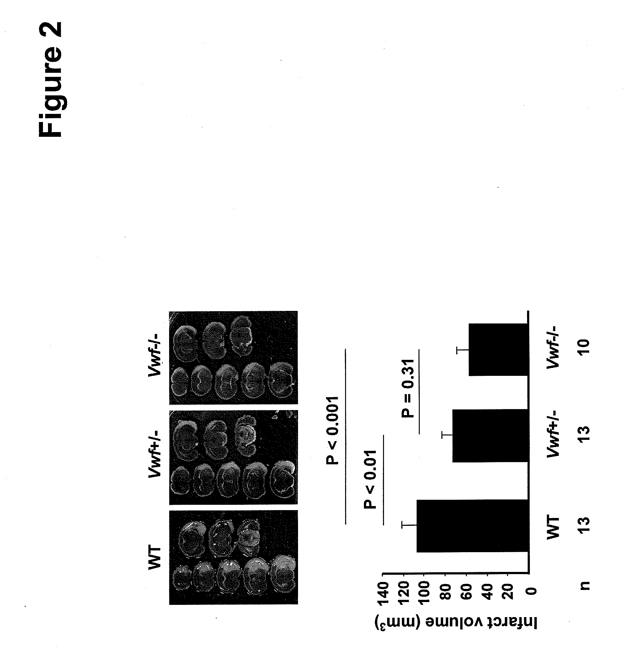 Von willebrand factor (VWF) inhibitors for treatment or prevention of infarction