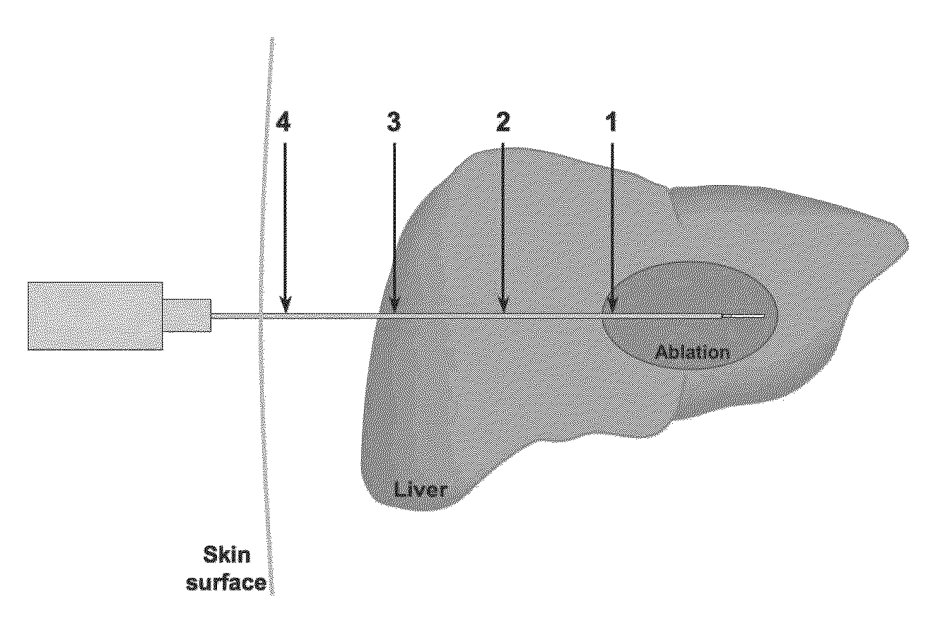 Energy delivery systems and uses thereof