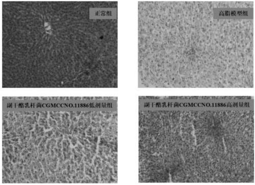 Lactobacillus rhamnosus with fatty liver disease inhibiting function and application thereof