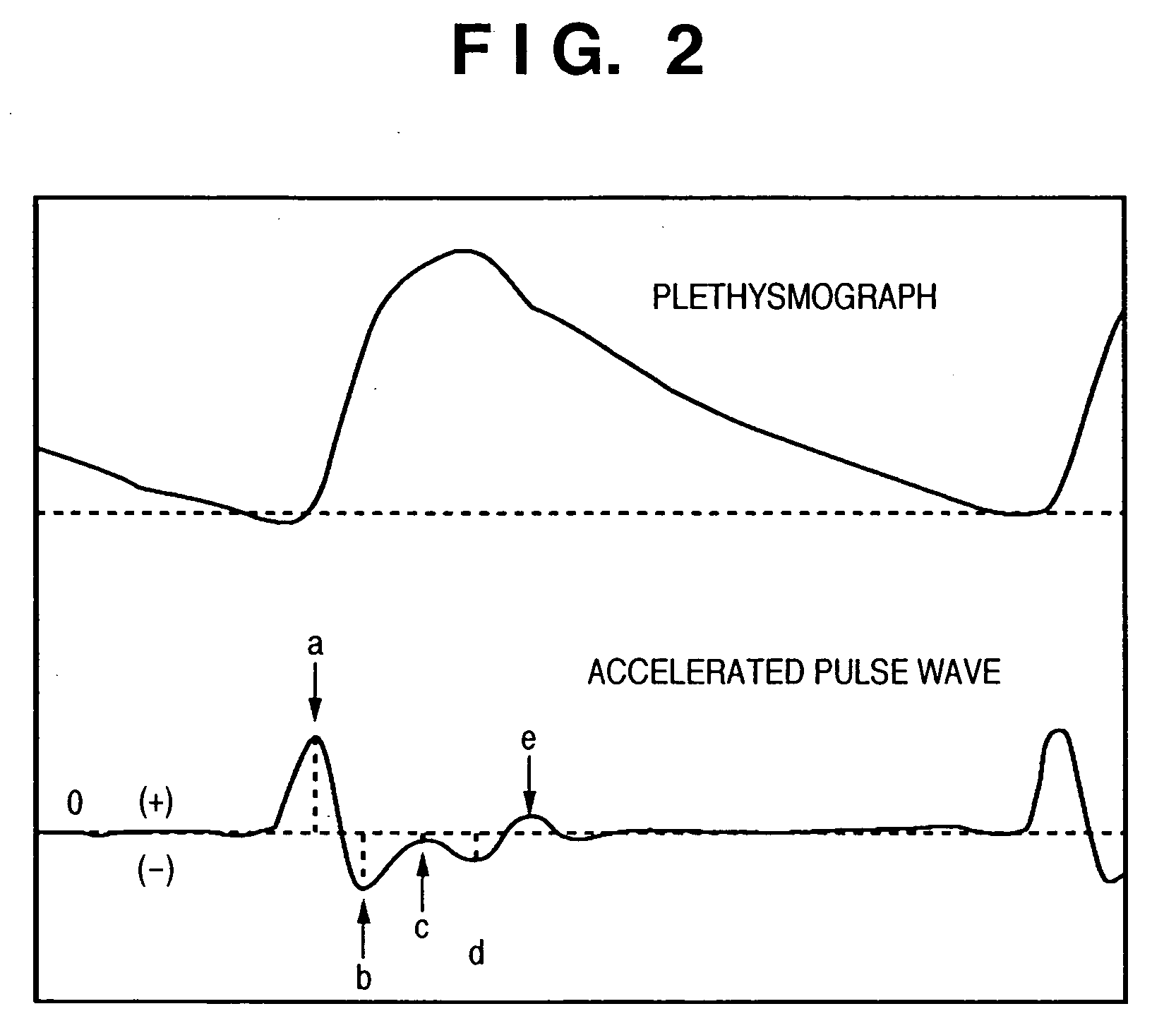 Blood pressure monitoring apparatus