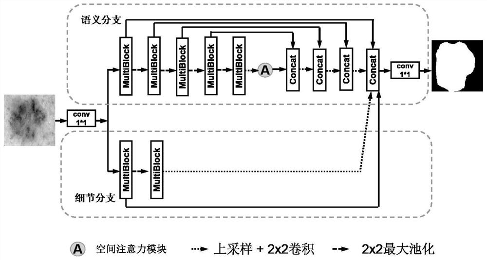 Skin cancer lesion segmentation method based on deep learning